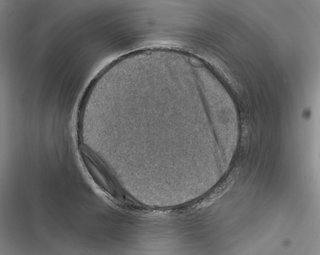 X0000116451038201001191548