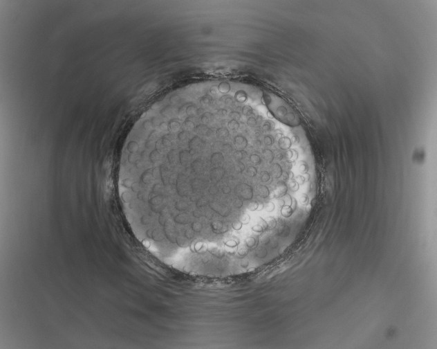 X0000116451106201001191547