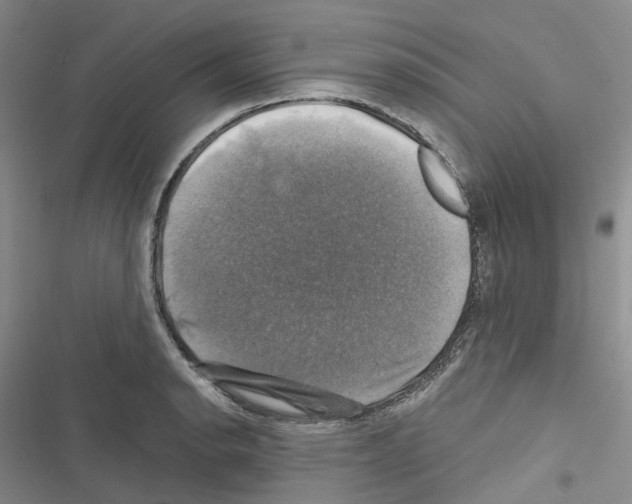 X0000116451134201001191547