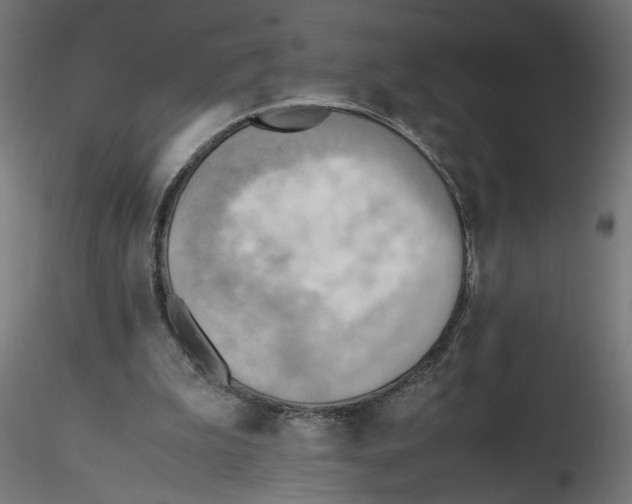 X0000116460199201001061045