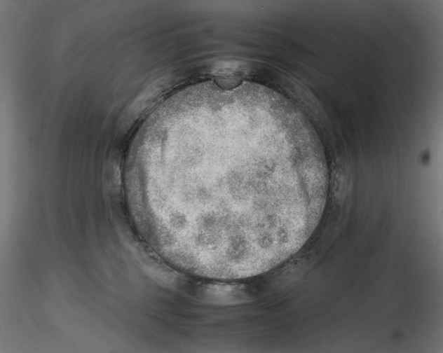 X0000116460375201001061043