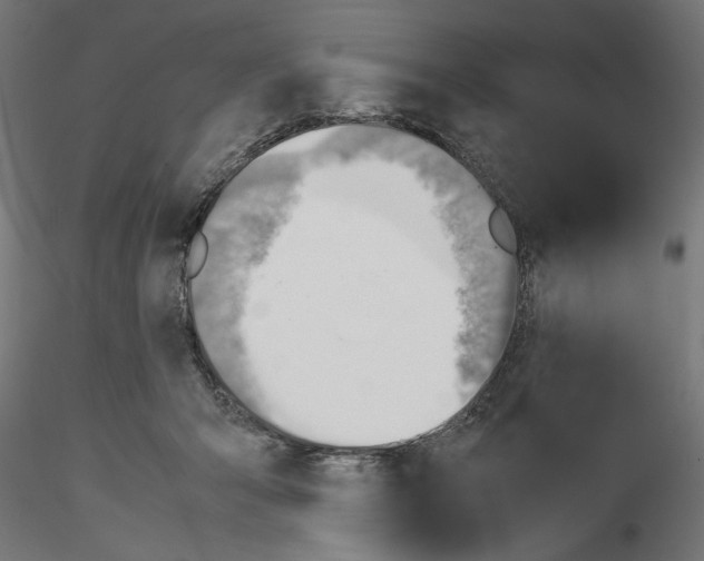 X0000116460415201001061042