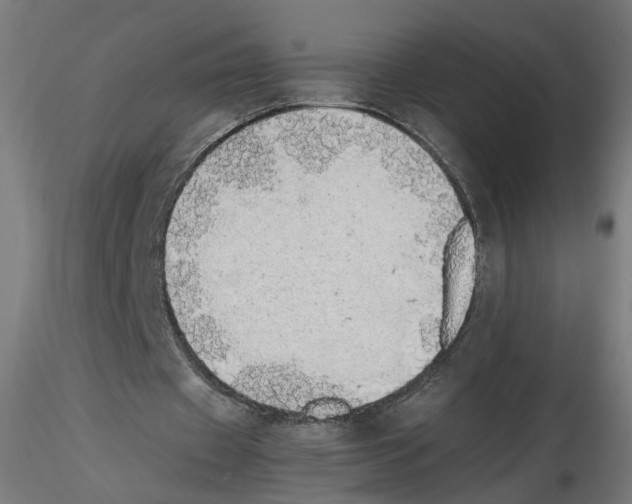 X0000116460433201001061041