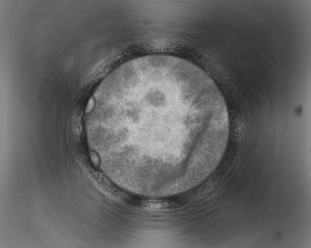 X0000116460746201001061038