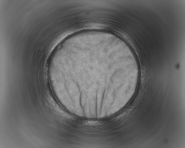 X0000116460835201001061036