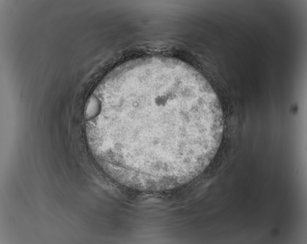 X0000116460913201001061035