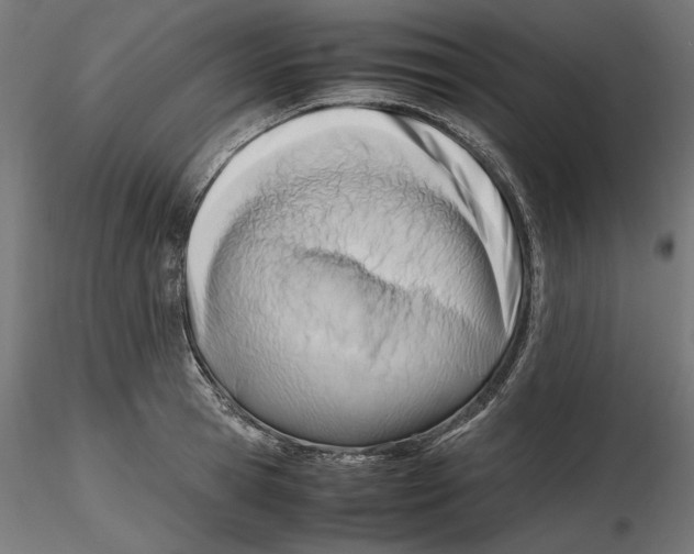 X0000116460945201001061035