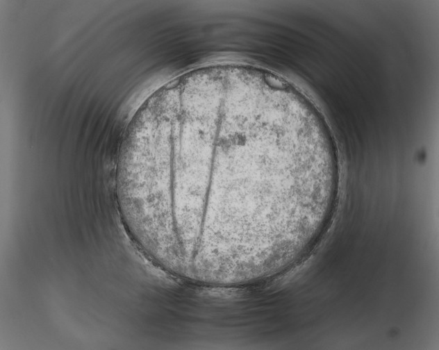 X0000116460953201001061035