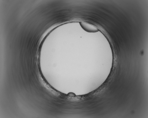X0000116460955201001061035