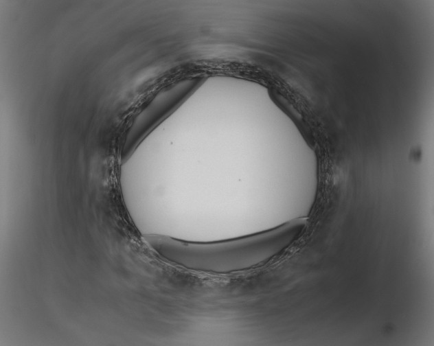 X0000116460965201001061035