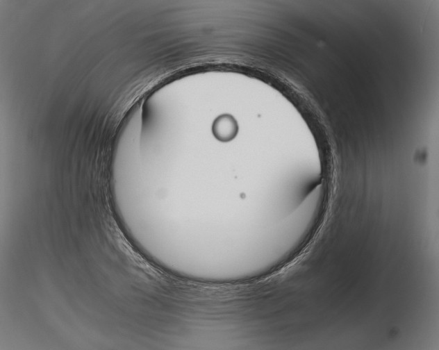 X0000116460977201001061035