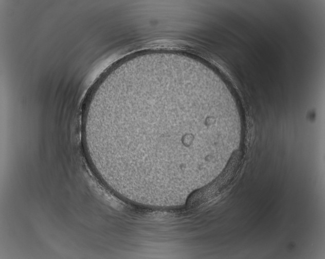 X0000116461075201001061033