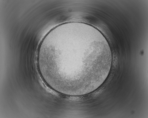 X0000116461094201001061033