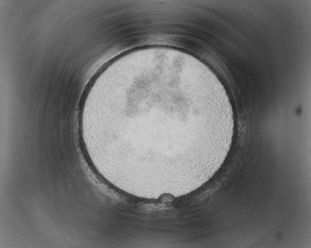X0000116461133201001061033