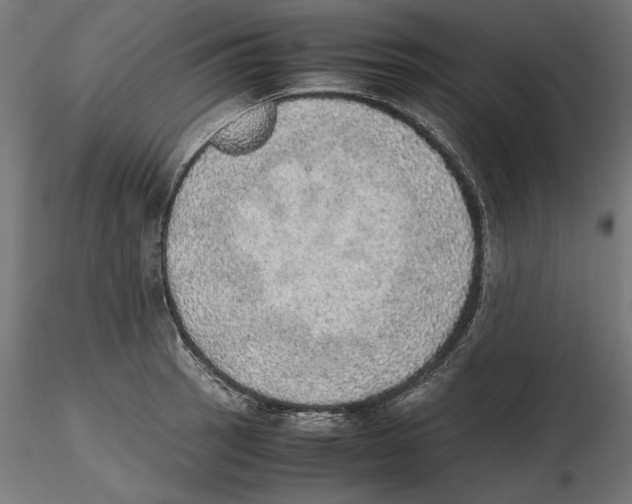 X0000116461137201001061033