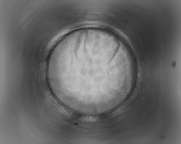 X0000116461411201001061028