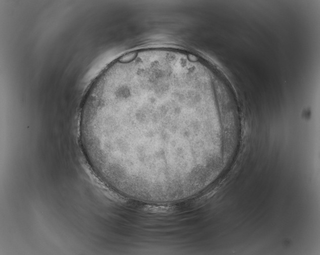 X0000116461415201001061029