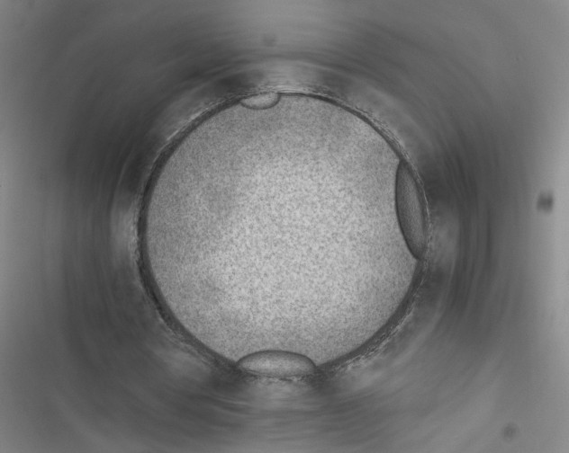 X0000116460386201001201305