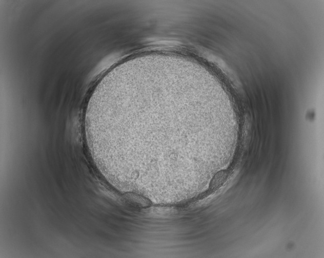 X0000116461354201001201251