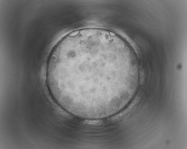 X0000116461415201001201251