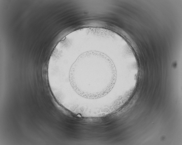 X0000116461433201001201251