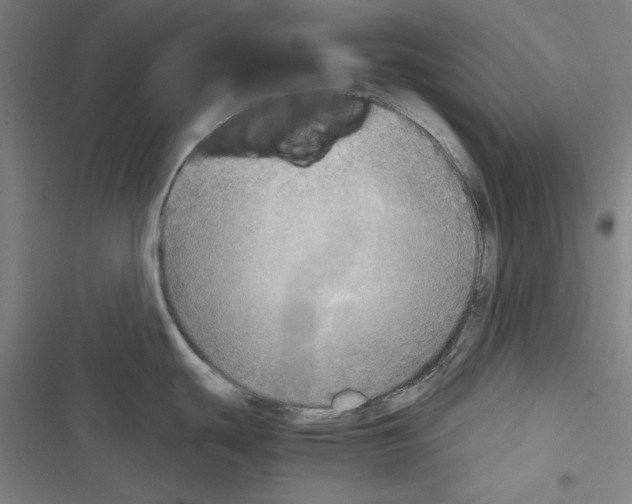 X0000116461439201001201251