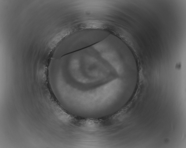 X0000116480305201001061126