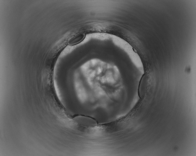 X0000116480313201001061125