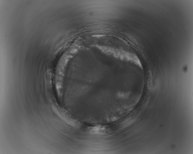 X0000116480366201001061125