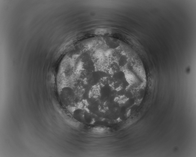 X0000116480375201001061125