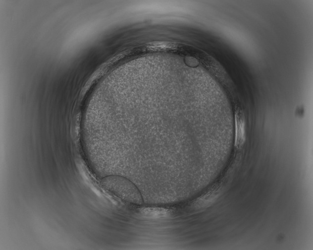 X0000116480435201001061123