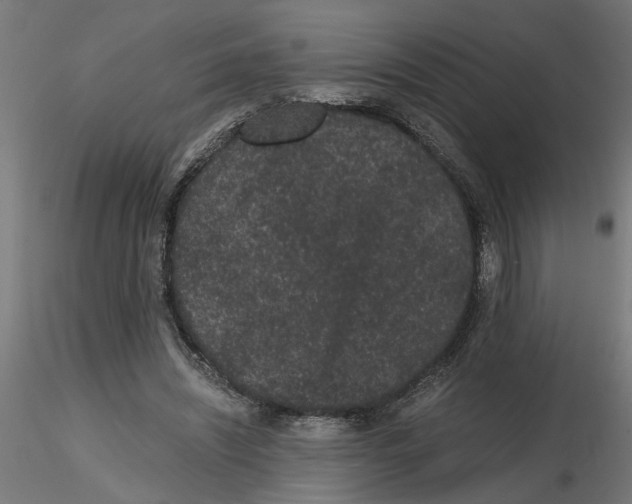 X0000116480444201001061123