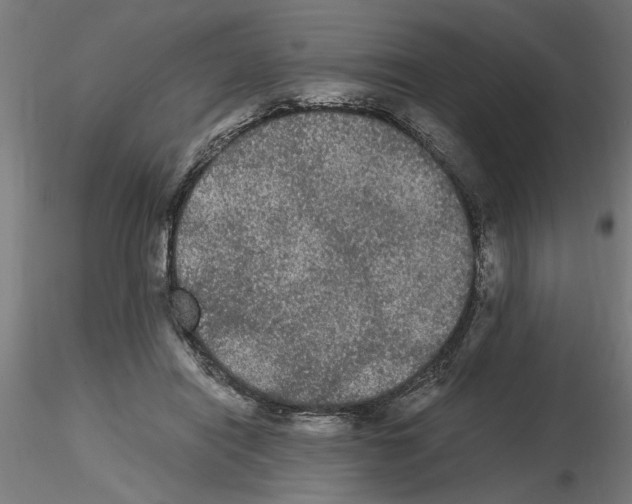 X0000116480454201001061123