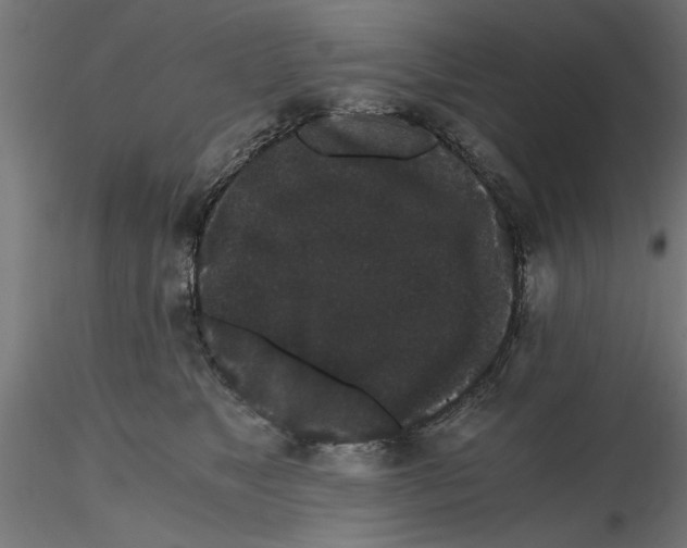 X0000116480517201001061123