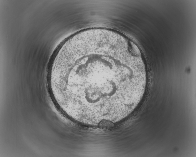 X0000116480991201001061116