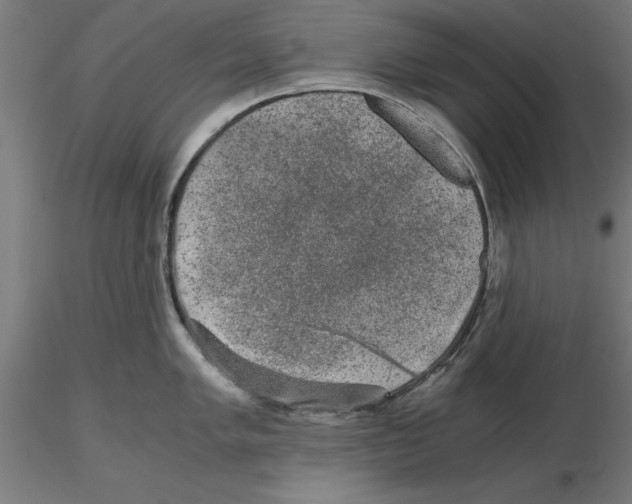 X0000116481005201001061116