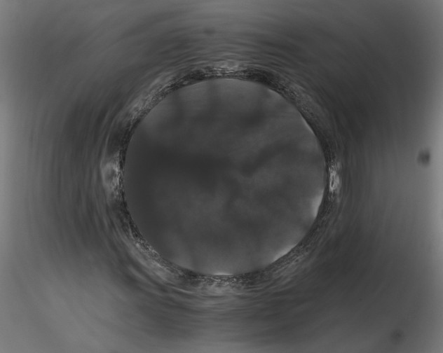 X0000116481011201001061115