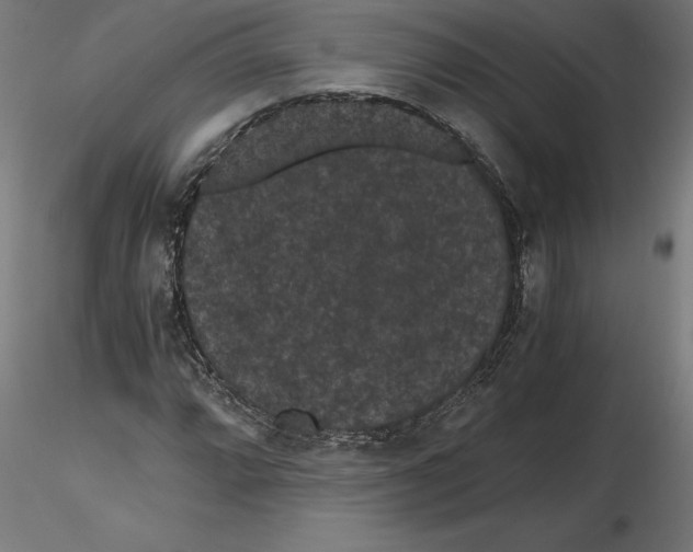 X0000116481064201001061115