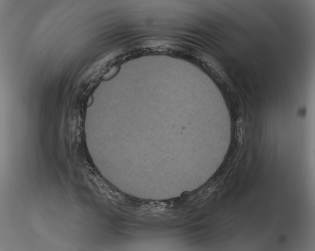 X0000116481111201001061114