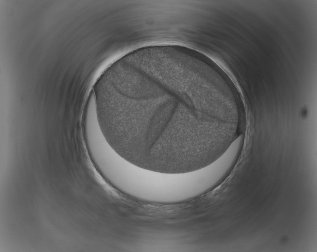 X0000116481197201001061113