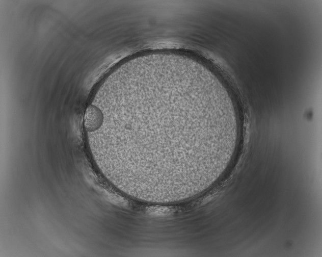 X0000116481217201001061113