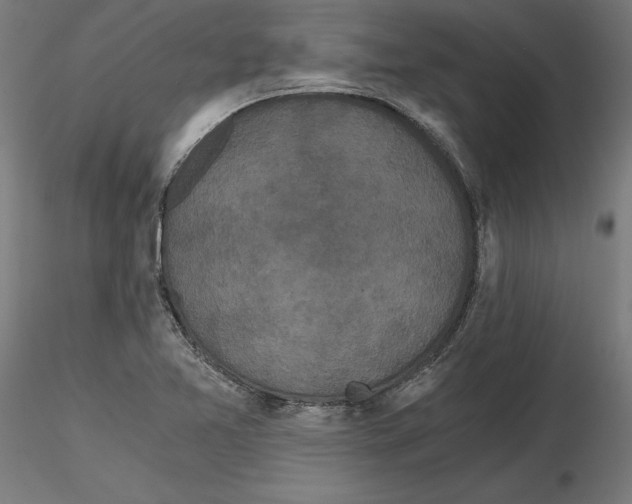 X0000116481365201001061111