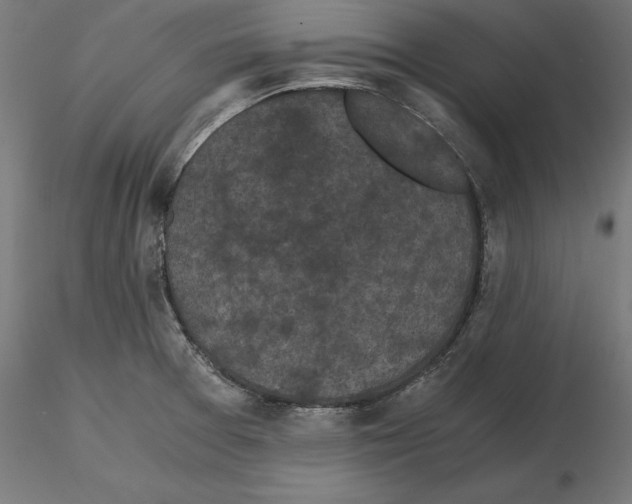 X0000116481377201001061111