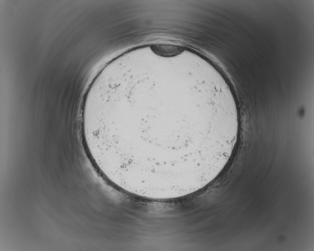 X0000116481379201001061111