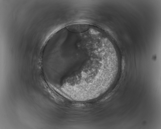 X0000116481405201001061110