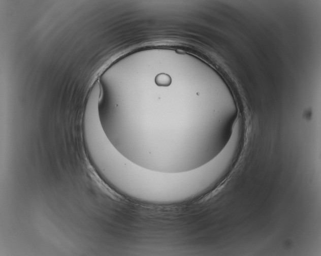 X0000116481417201001061110