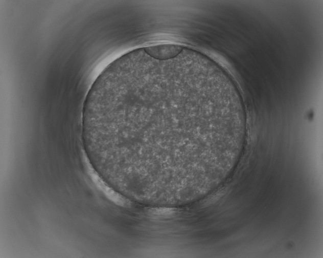 X0000116481431201001061111