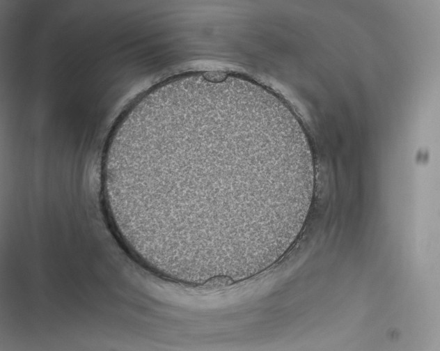 X0000116480015201001201352