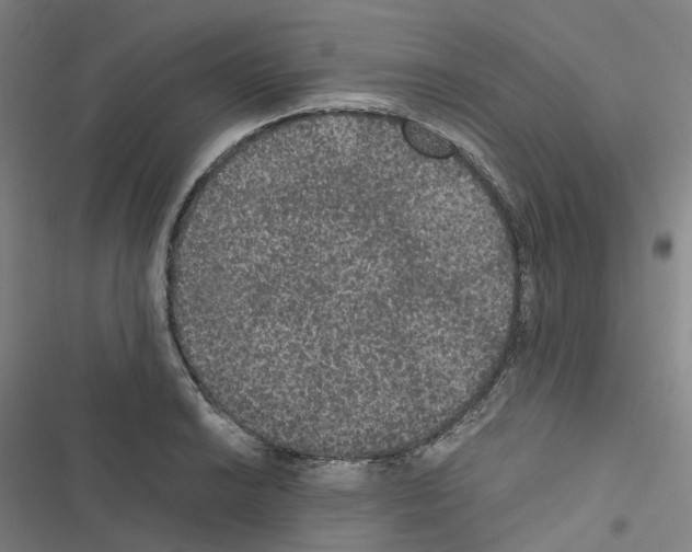 X0000116481038201001201338