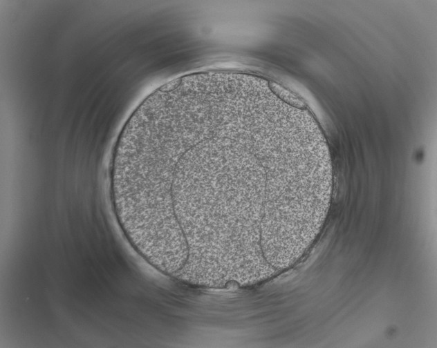 X0000116481483201001201332